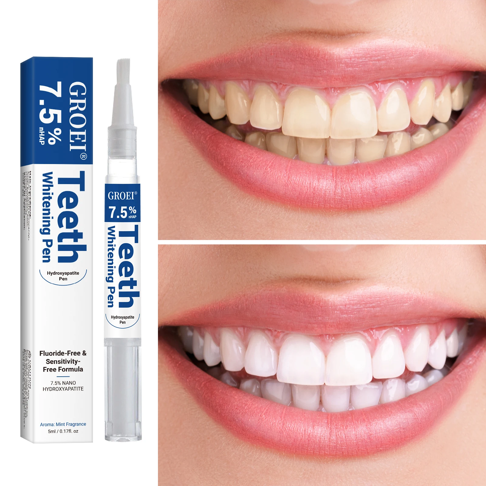 Hydroxyapatite Tooth Whitening – Teeth Whitening Singapore recenzja i cena