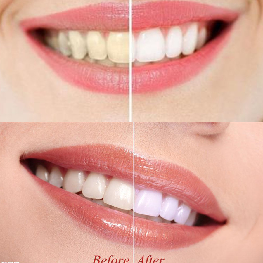 Bamboo Charcoal Teeth Tooth De – Teeth Whitening Levels recenzja i cena