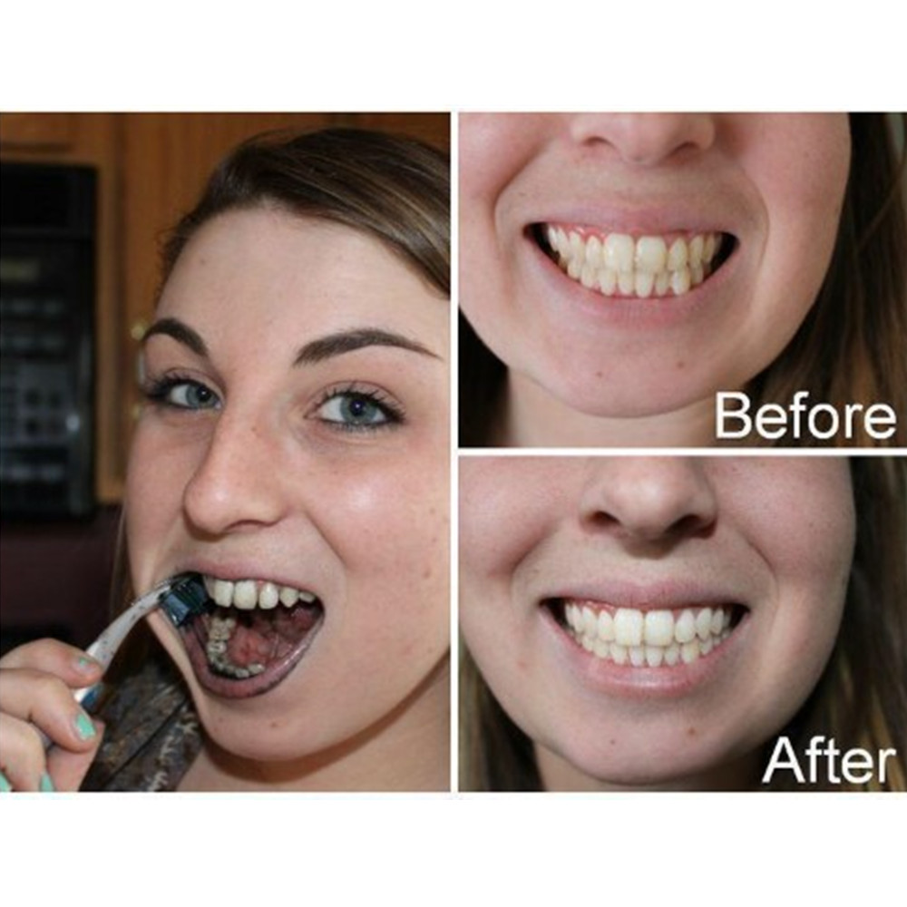 Bamboo Charcoal Teeth Tooth De – Teeth Whitening Levels recenzja i cena