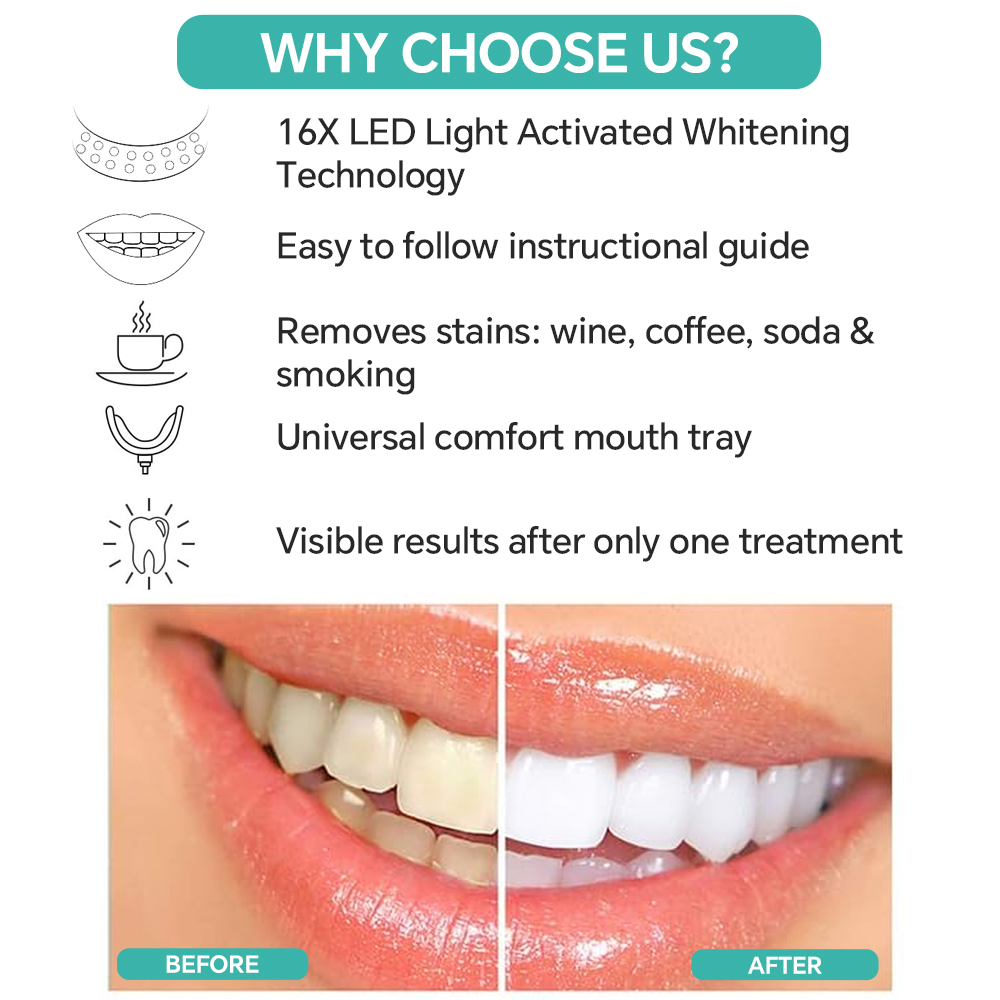 Teeth Whitening Accelerator Li – Teeth Whitening/Bleaching recenzja i cena