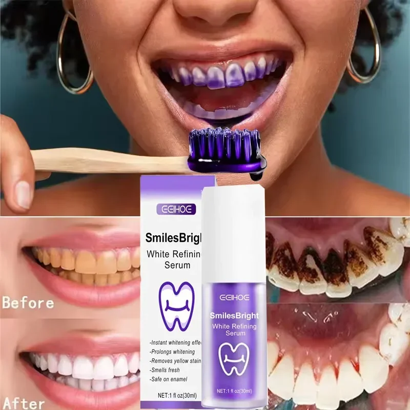 Teeth Cleansing Whitening Toot – Teeth Whitening Korea recenzja i cena