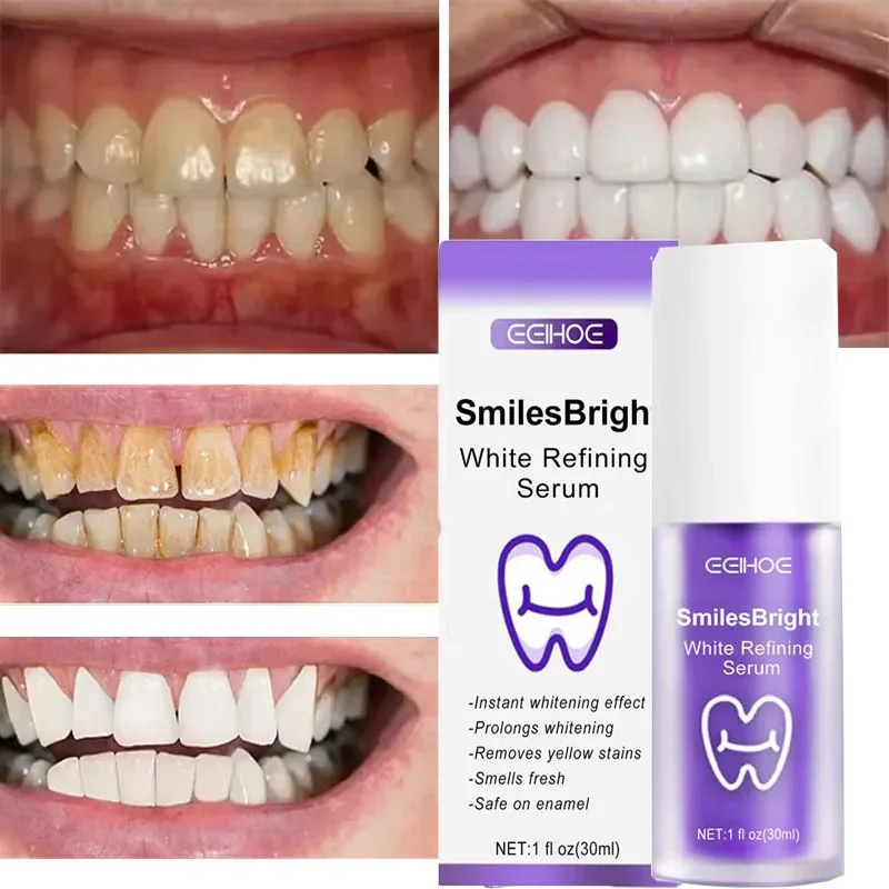 Teeth Cleansing Whitening Toot – Teeth Whitening Korea recenzja i cena