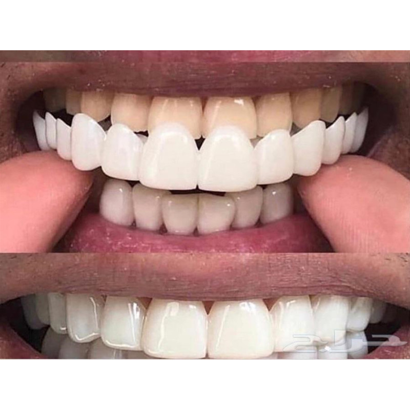 Soft Silicone Gel Dental Oral  – Teeth Whitening Moulds recenzja i cena