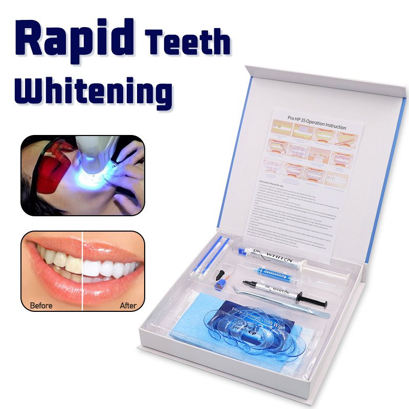 Professional Teeth Whitening K – Teeth Whitening Opalescence recenzja i cena