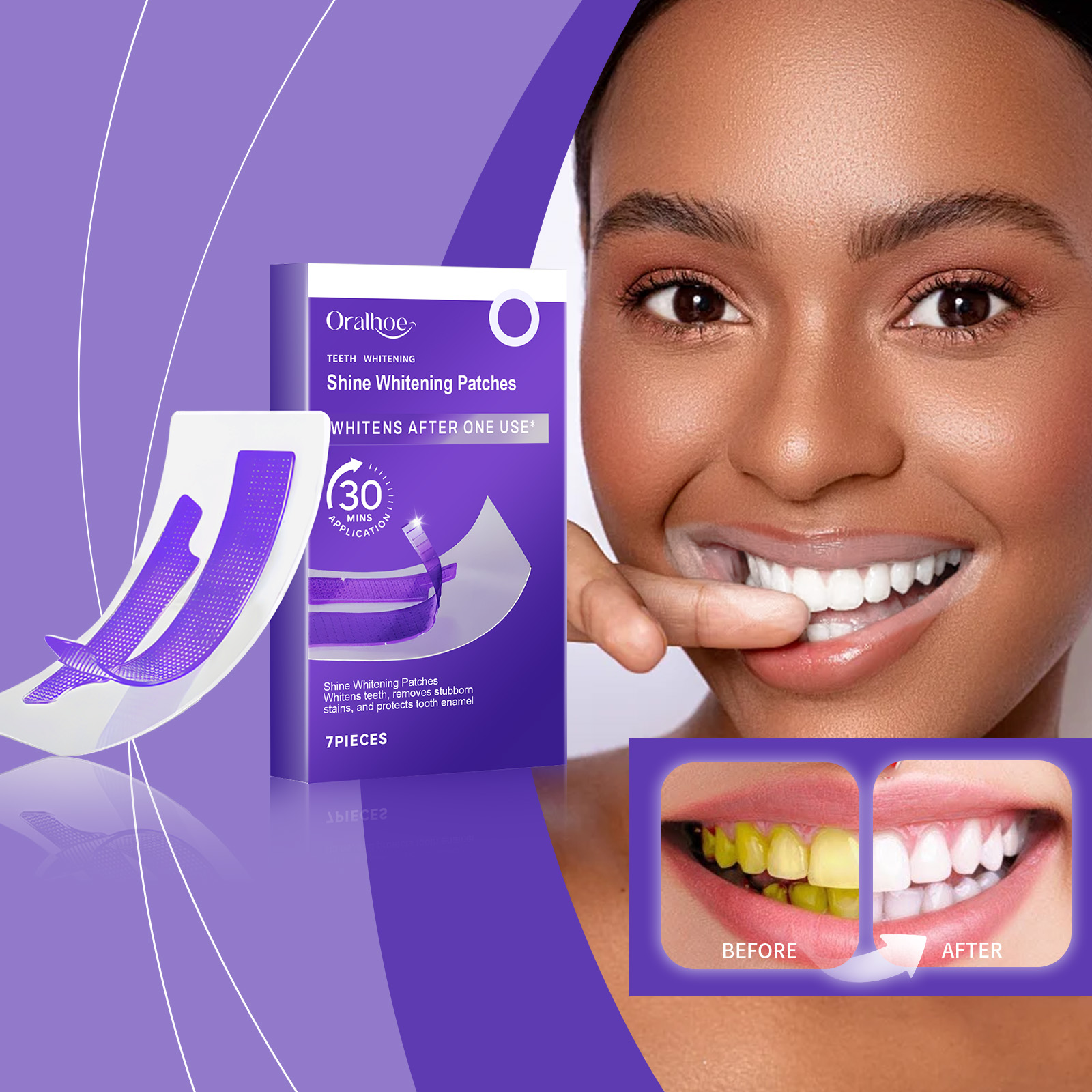 Purple Teeth Whitening Strips  – Teeth Whitening/Bleaching recenzja i cena
