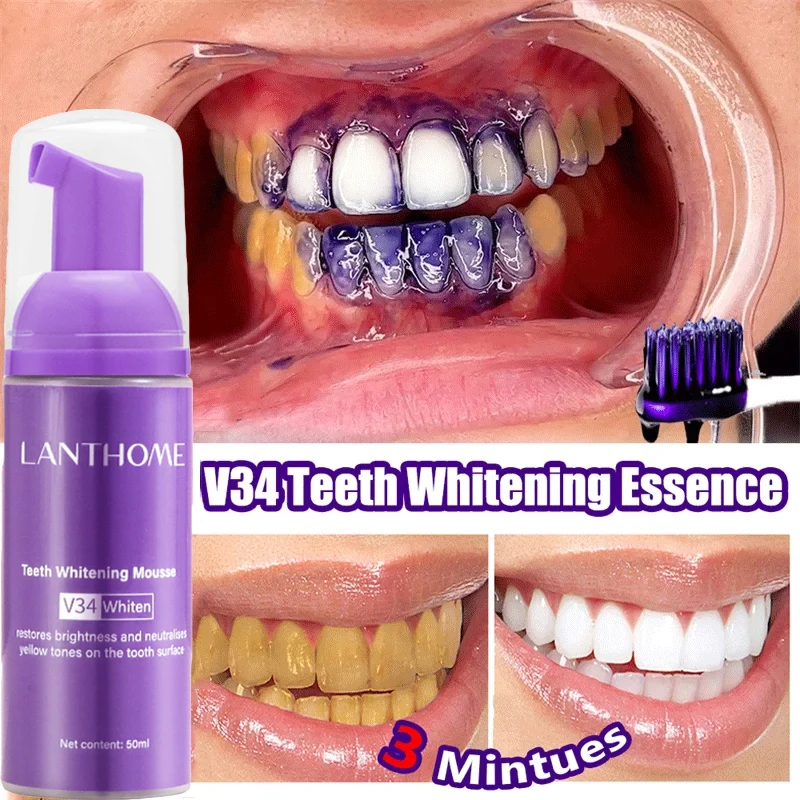 V34 Teeth Whitening Mousse Too – Teeth Whitening/Bleaching recenzja i cena