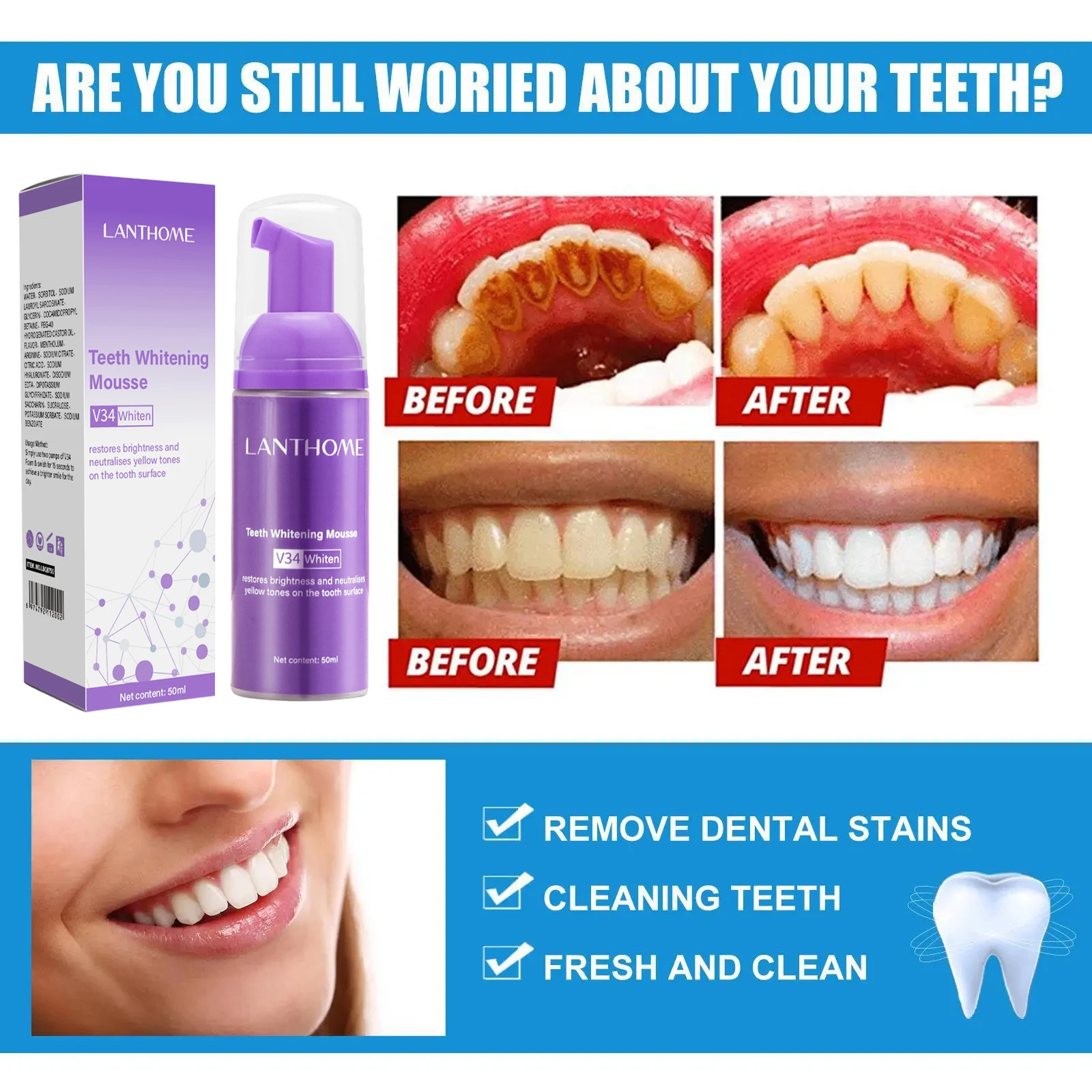 V34 Teeth Whitening Mousse Too – Teeth Whitening/Bleaching recenzja i cena