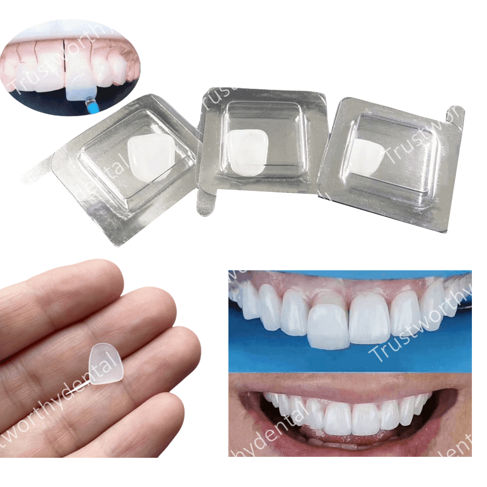 Dental Composite Porcelain Ven – Teeth Paint Whitening recenzja i cena