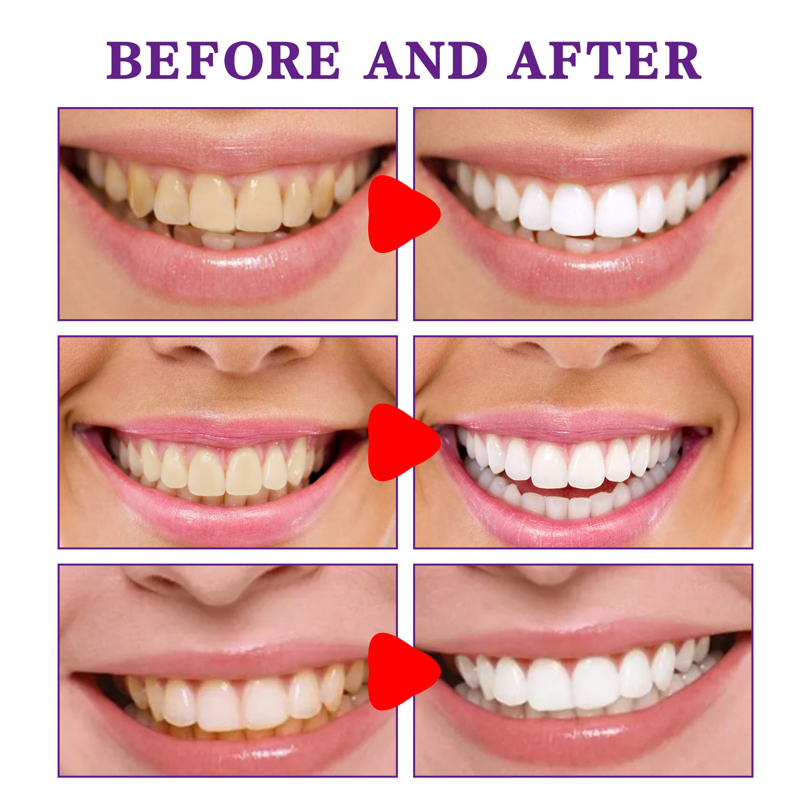 Teeth Cleansing Whitening Toot – Teeth Whitening Korea recenzja i cena