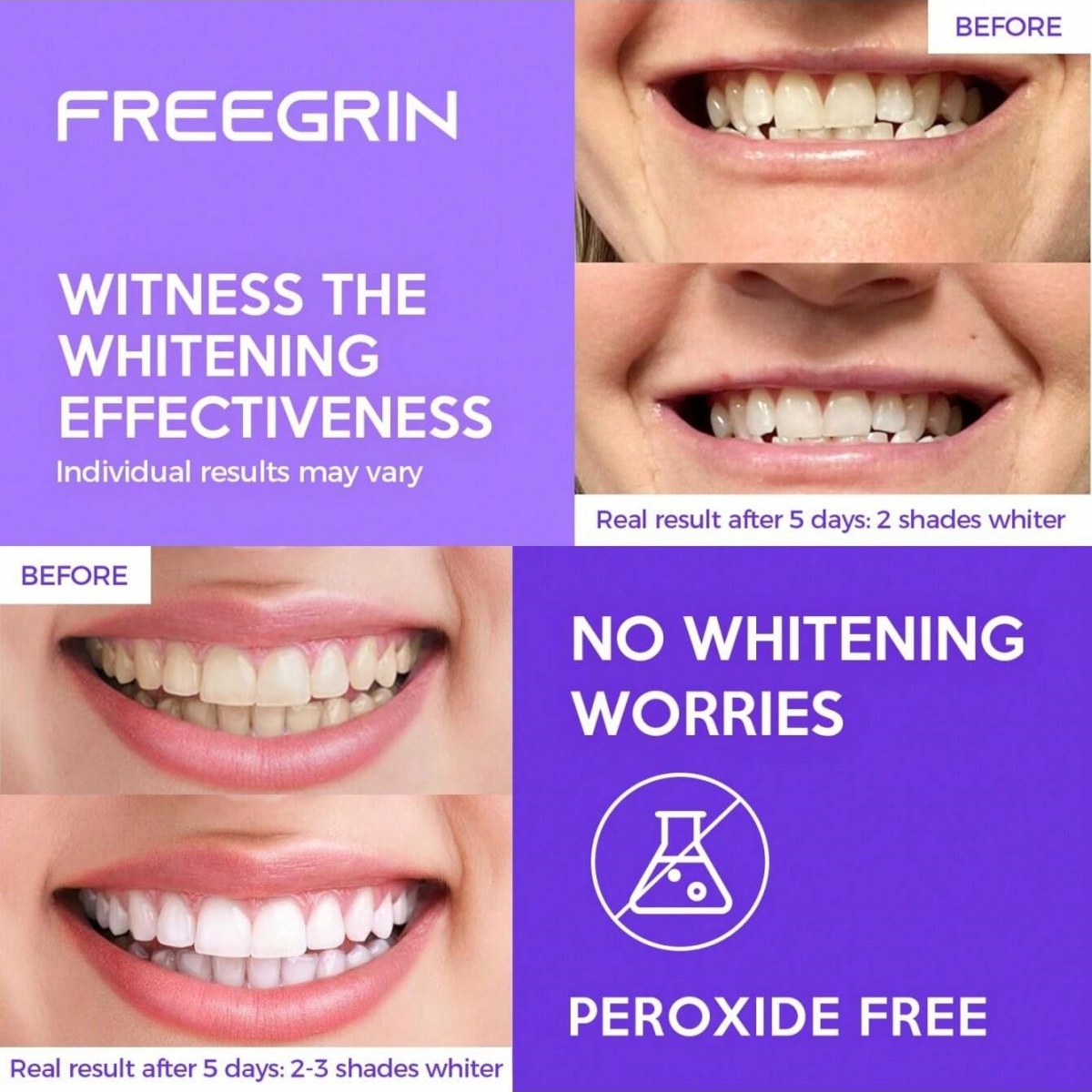 Deluxe Whitening Teeth Sticker – Teeth Whitening Singapore recenzja i cena