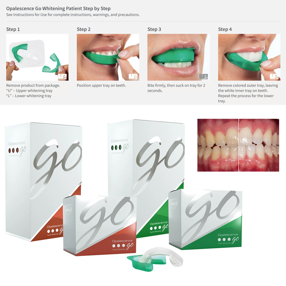 Opalescence Go Teeth Whitening – Teeth Whitening Opalescence recenzja i cena