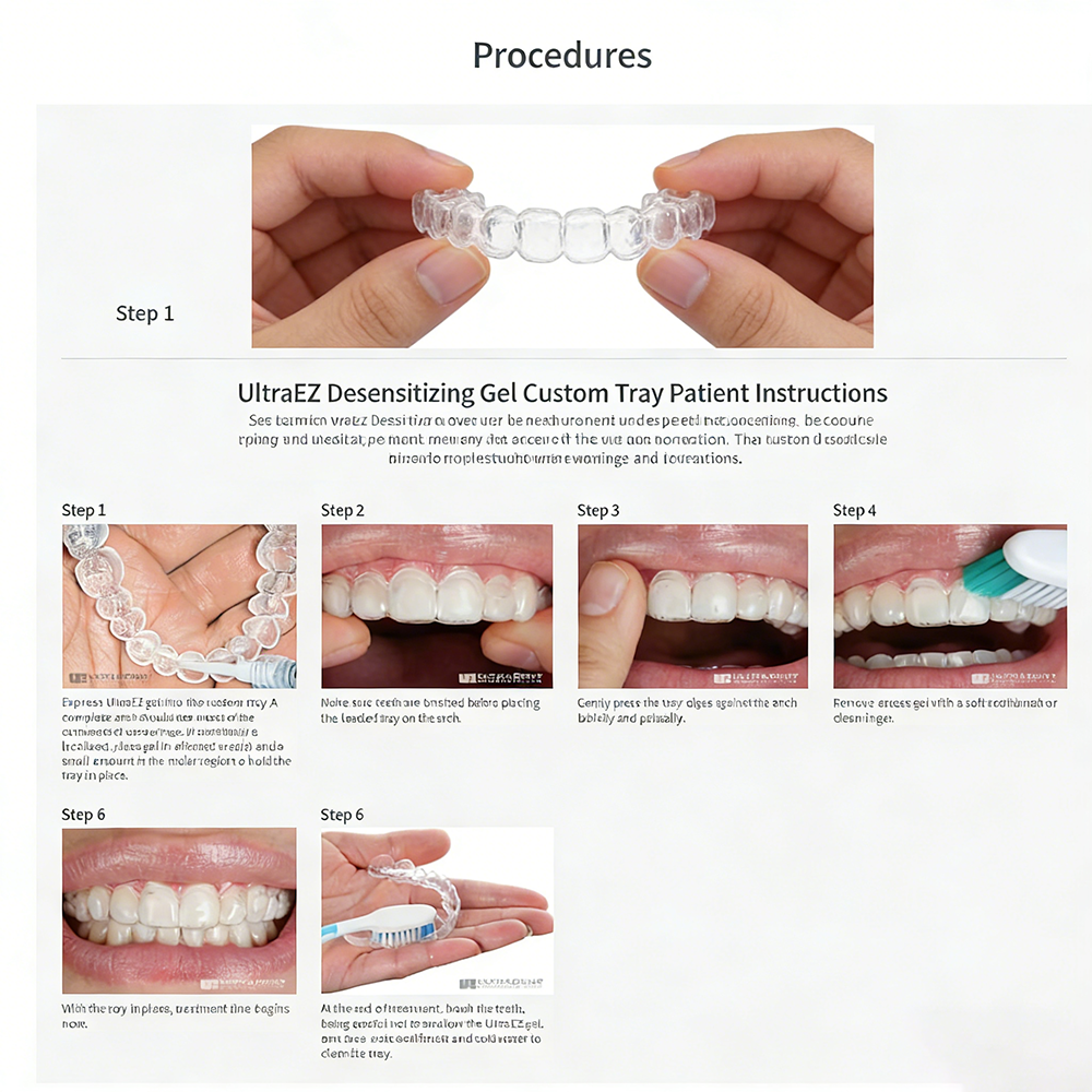 Ultra Ez Dental Desensitizing  – Teeth Whitening Opalescence recenzja i cena