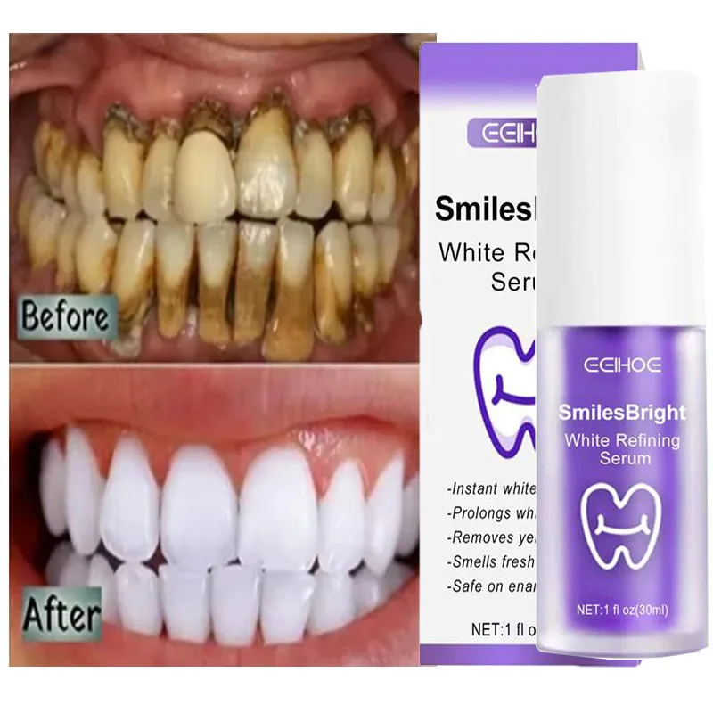 Whitening Toothpaste Teeth Cle – Teeth Whitening Korea recenzja i cena