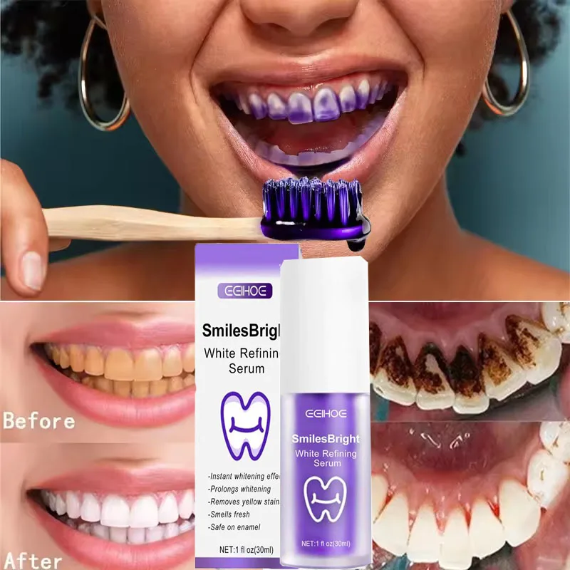 Whitening Toothpaste Teeth Cle – Teeth Whitening Korea recenzja i cena