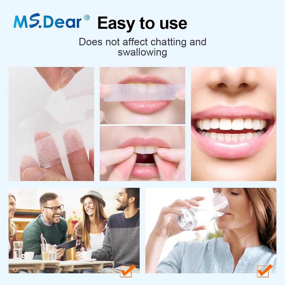 7/14/21/28/70 Pairs 9D Gel Tee – Teeth Whitening Strips Crest recenzja i cena
