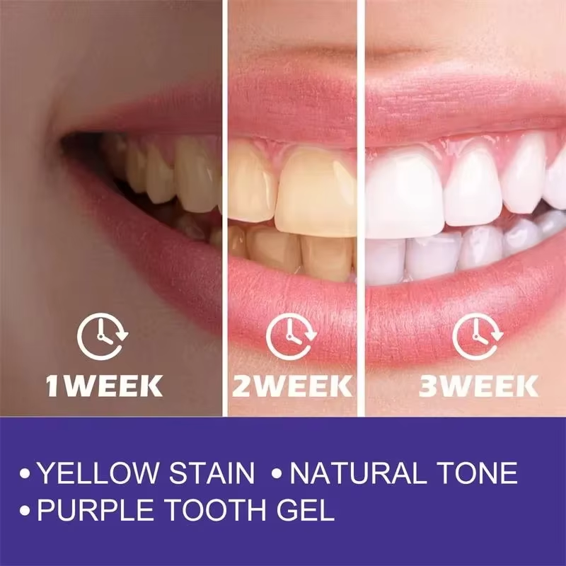 Teeth Cleansing Whitening Toot – Teeth Whitening Korea recenzja i cena